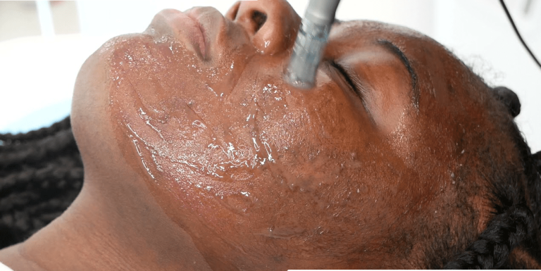 Microneedling-7