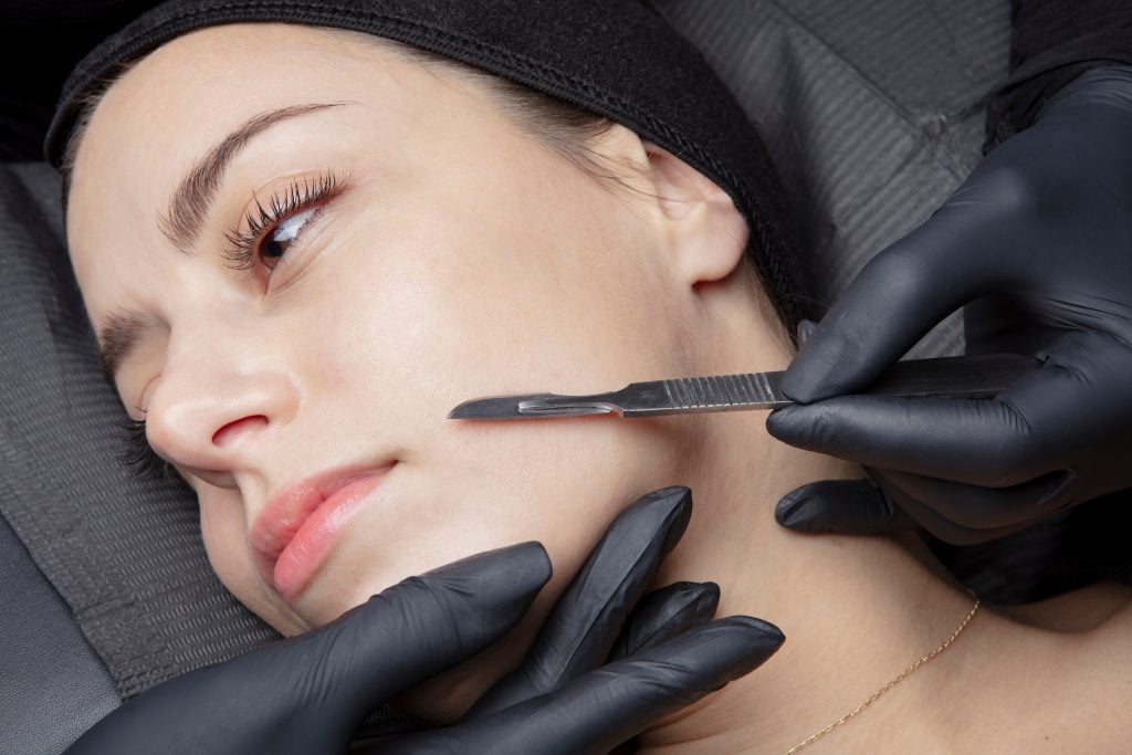 dermaplaning procedure