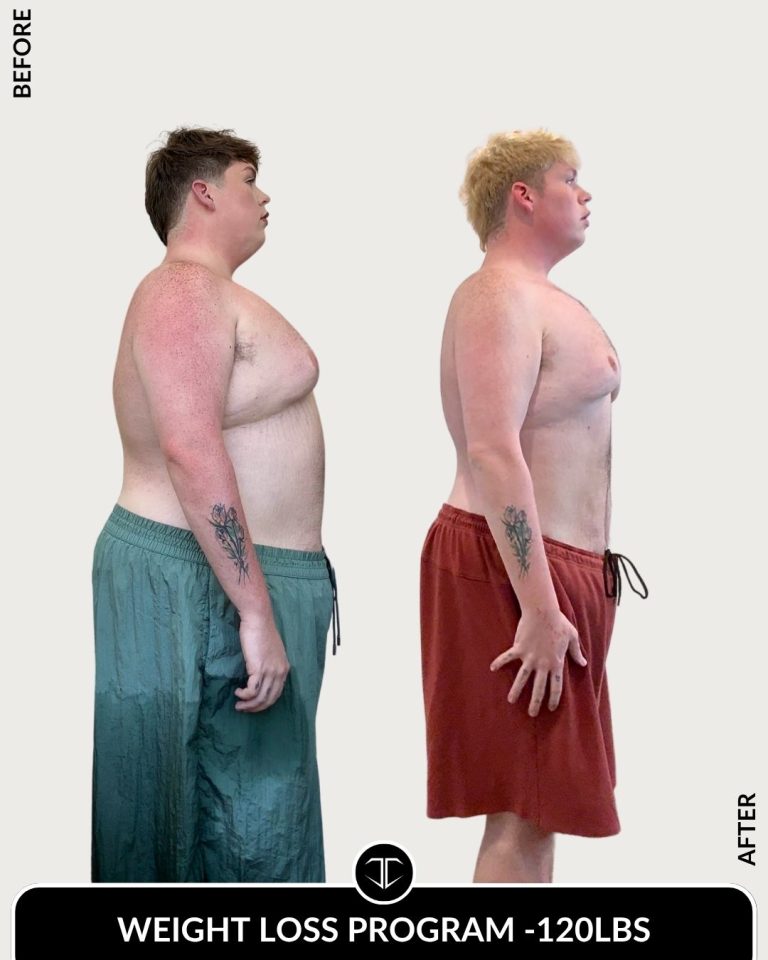 Weight Loss Before and After - Tirzepatide