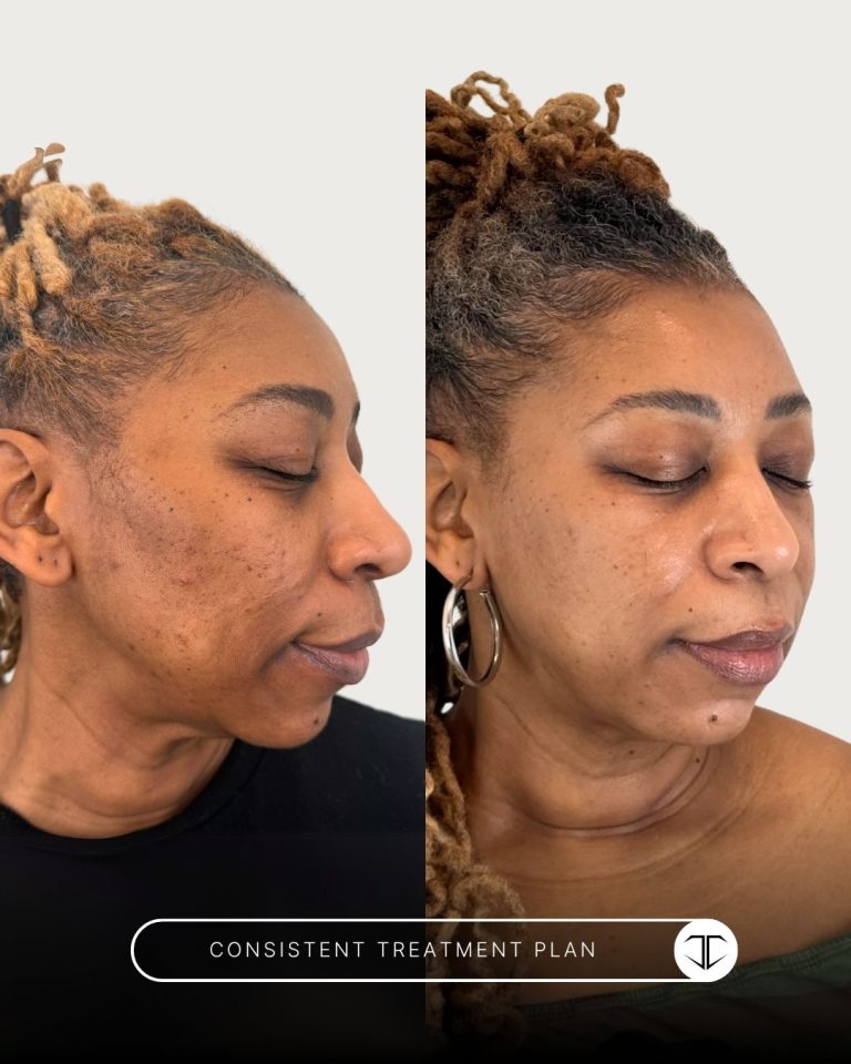 Consistent Treatment Before and After
