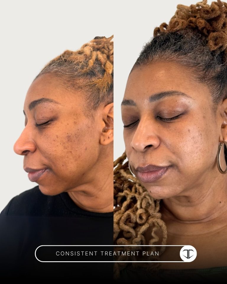 Consistent Treatment Before and After